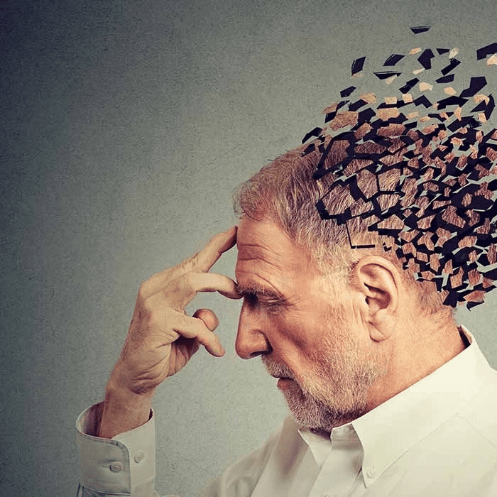 روش های تشخیص و درمان آلزایمر